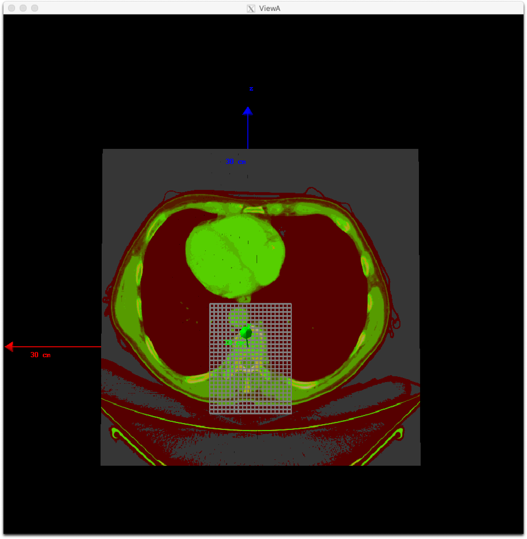../../_images/rtdose_grid_option2.png